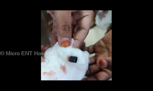 Micro ENT Hospital - General Hospitals in Tolichowki, Hyderabad