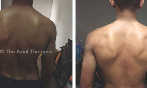The Axial Therapist - Job Training in Bandra West, Mumbai