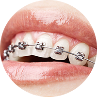 Sinhgad Dental College and hospital pune image