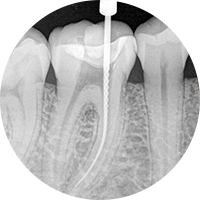 Sinhgad Dental College and hospital pune image