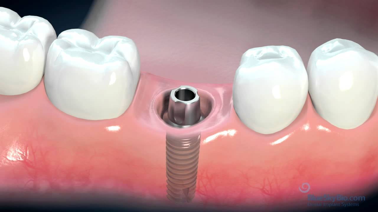 ITS Dental CollegeHospital & Research Centre image
