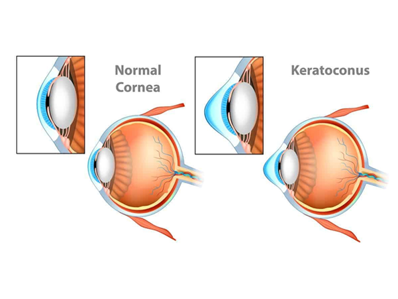 Samprathi Eye Hospital image