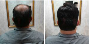 Sangam Hair Weaving Clinic image