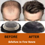 Sangam Hair Weaving Clinic image