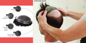 Sangam Hair Weaving Clinic image