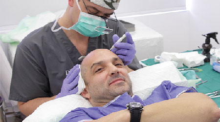 Hair Transplant in Chandigarh image