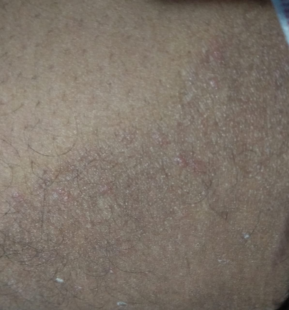 skin of Multicare Homeopathy Clinic