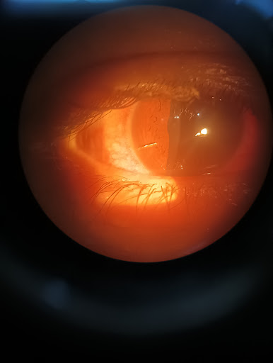 Gayatri Eye Hospital image