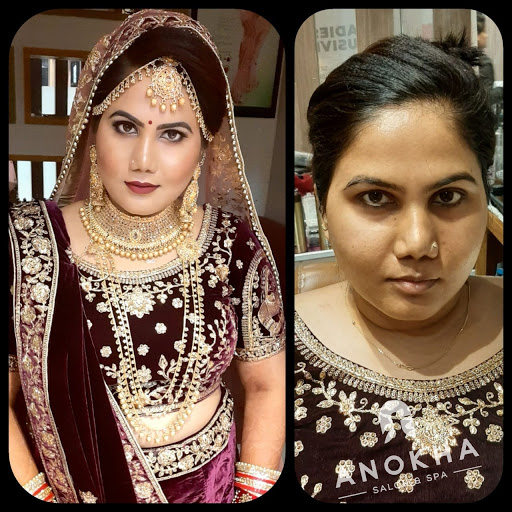 Before & After Results of Anokha parlour