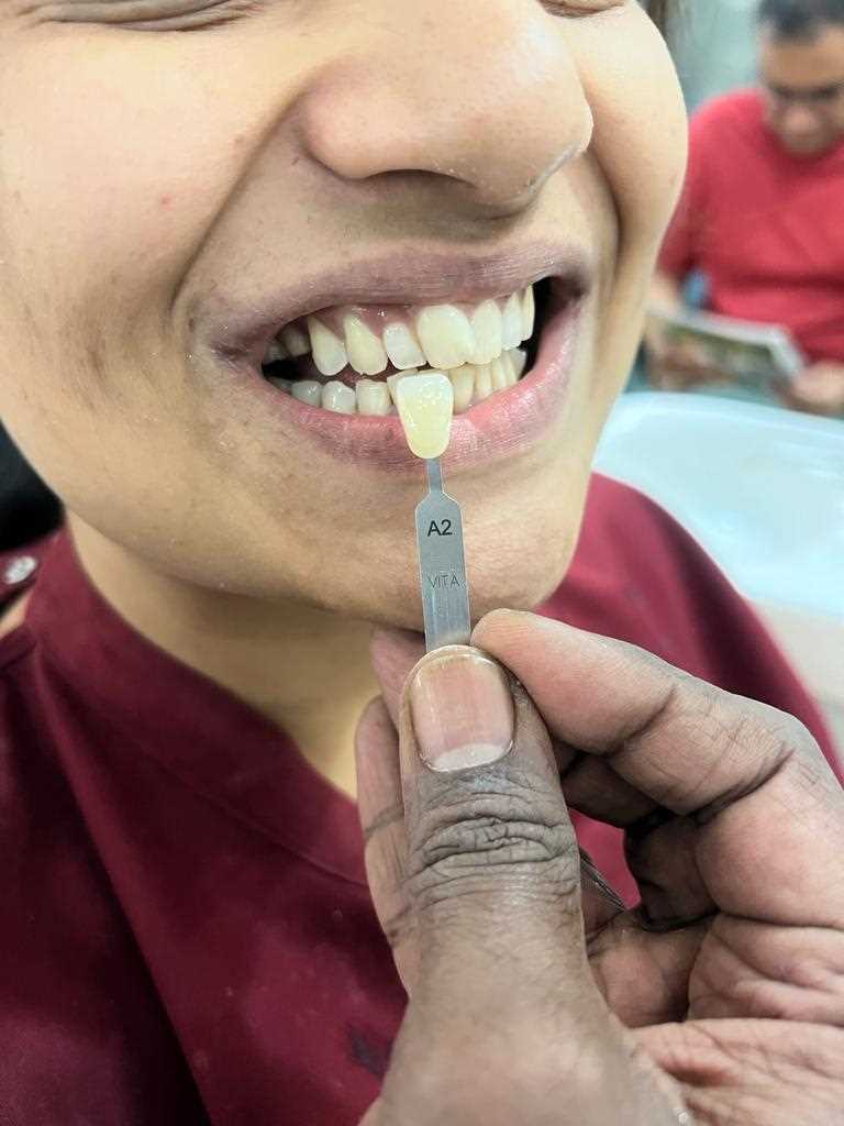 Dental of Smile Dental Care - Best Dental Care in Mysore