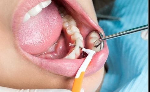 Dental of Smile Dental Care - Best Dental Care in Mysore