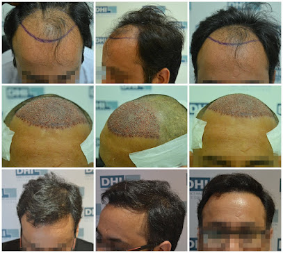 Hair Transplant in Chandigarh image