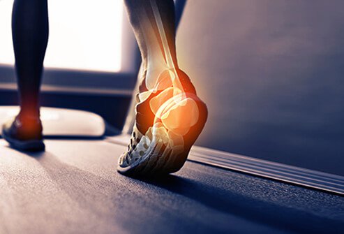 Patient Walk Training of Multi Speciality Physiotherapy Clinic-Best Physiotherapy Clinic