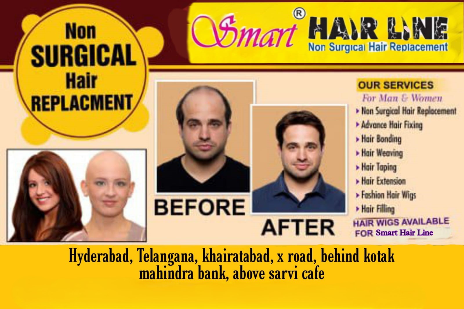 Smart Hair Line