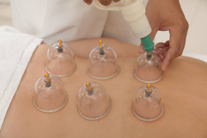 Health Care Cupping Therapy  Bajhera Khurd Ghaziabad